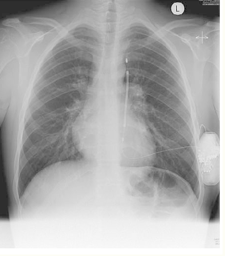 HEGPCardio | Patients